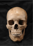 Accession number 16026 – cranium with cut marks across the forehead Photo: Christer Åhlin, SHMM 